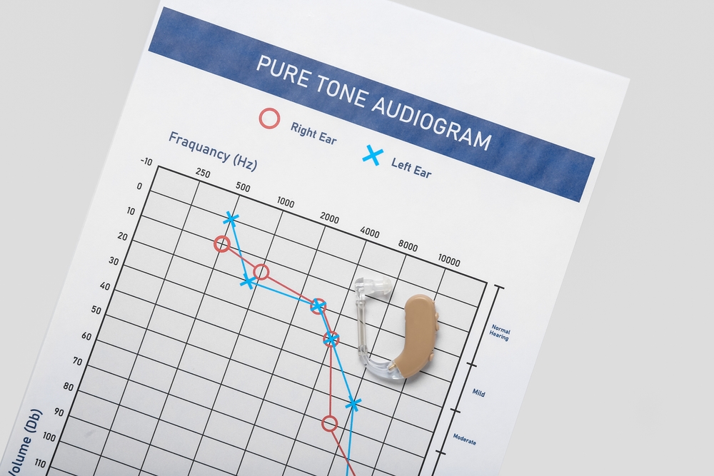 An audiogram chart labeled Pure Tone Audiogram with data points for right and left ear, and a hearing aid resting on the paper.